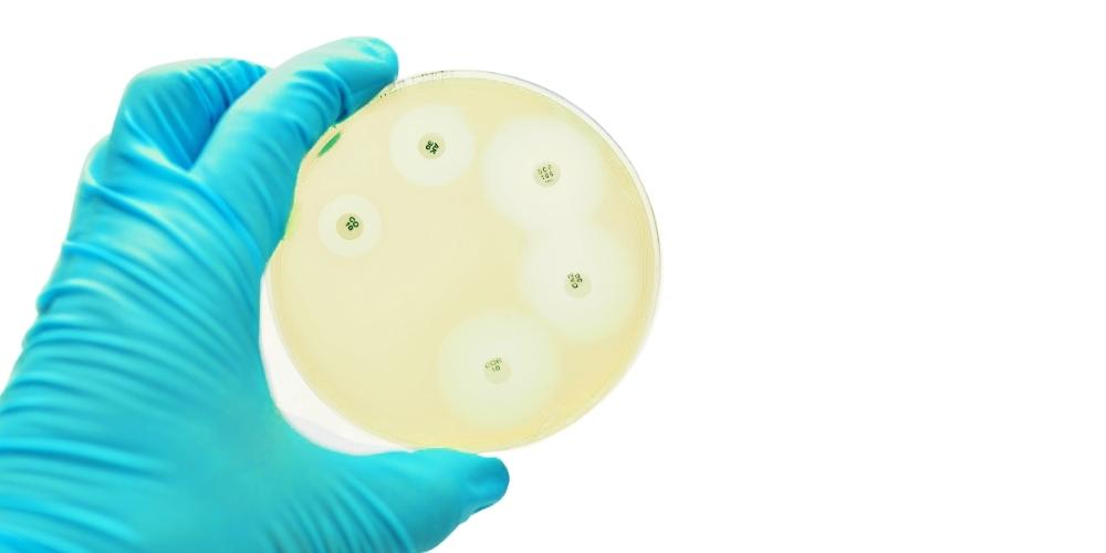 Agar Diffusion Methods A Disk Diffusion Method Of Microbial Extract Agar Diffusion Methods A Disk Diffusion Method Of Microbial Extract