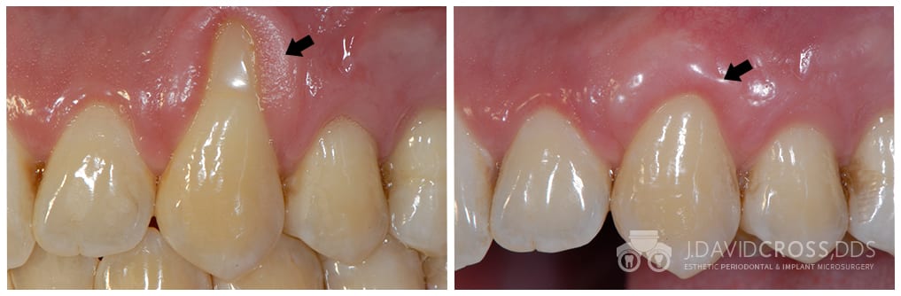 Boost Connective Tissue Health: Simple Tips & Tricks
