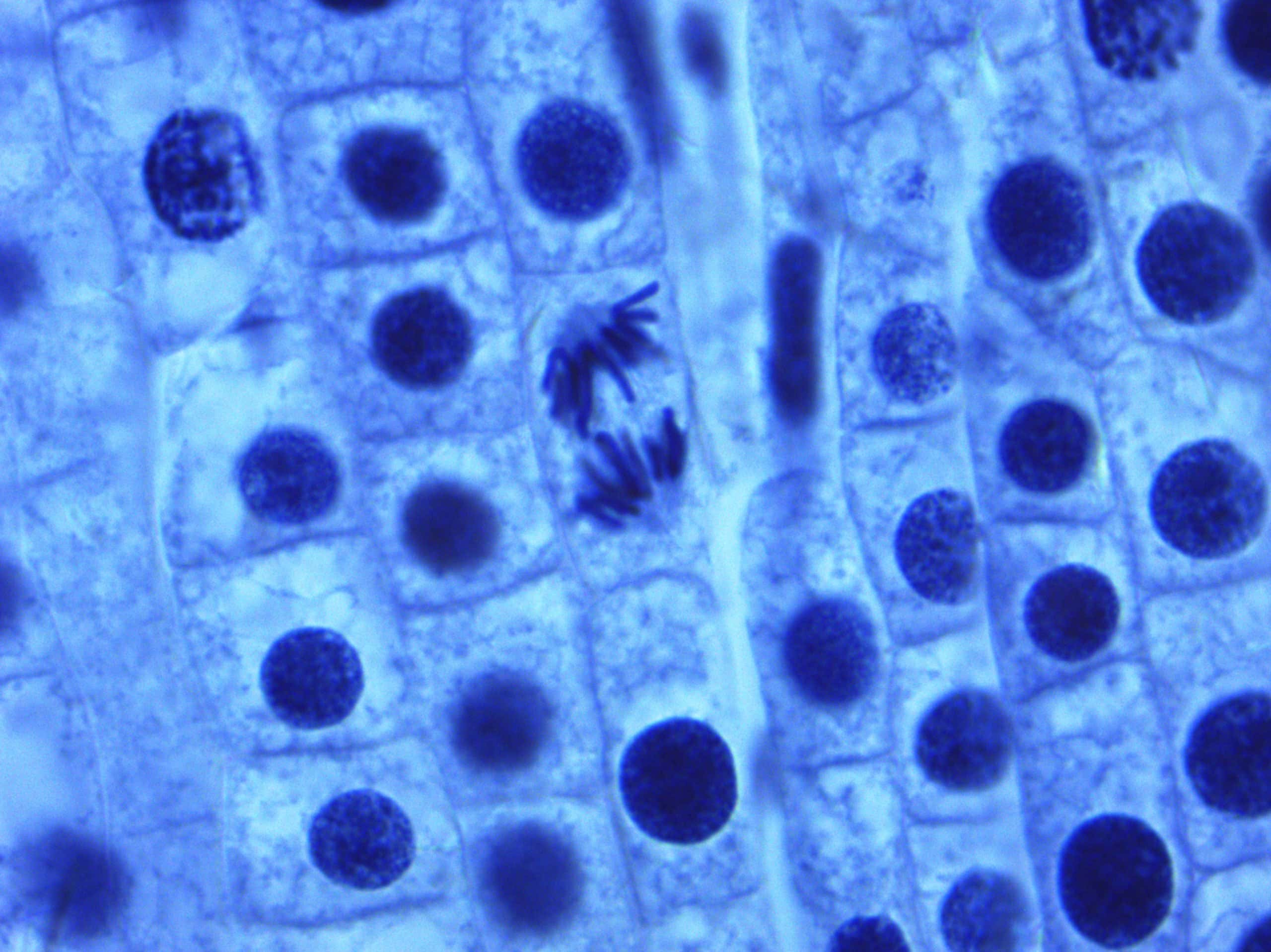 Unveiling Cell Division Secrets in Onion Root Tips