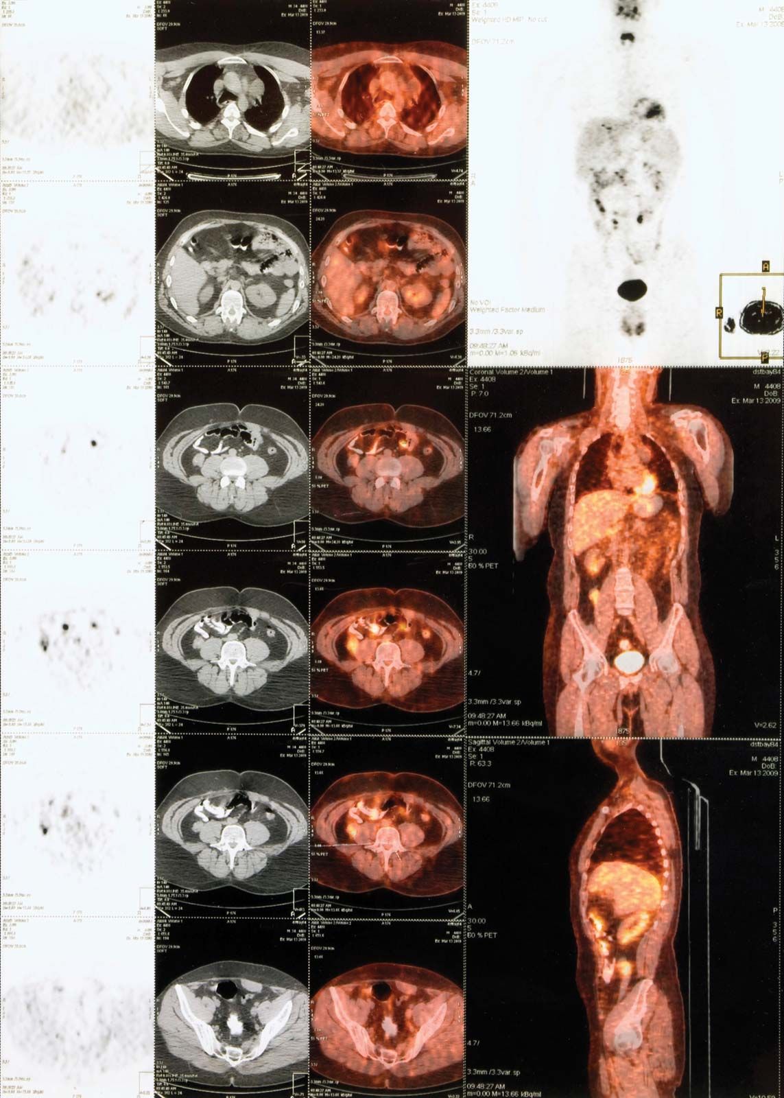 Explore Exciting Positron Emission Tomography Jobs Opportunities