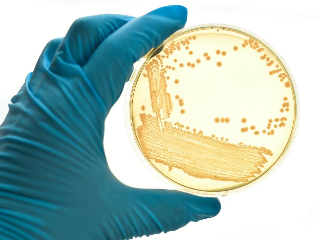Mastering Pure Culture Techniques in Microbiology for Accurate Results